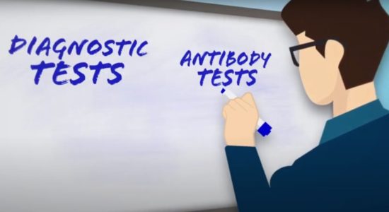 Antibody tests