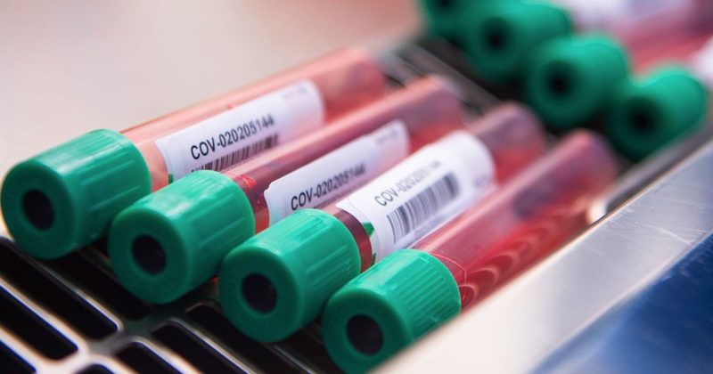 कोरोनावायरस वैक्सीन