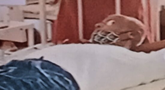 म्यूकोर्मिकोसिस