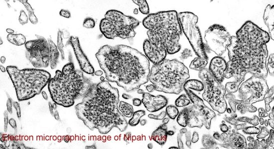 Central team visits to trace the source of Nipah virus