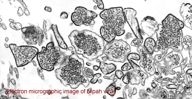 Central team visits to trace the source of Nipah virus