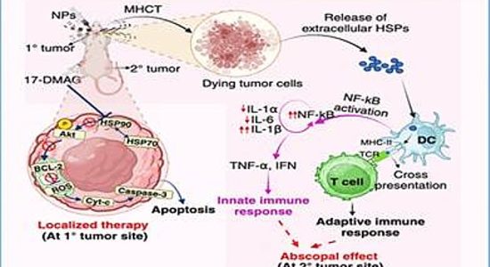 Treatments like nanotherapy possible for cancer
