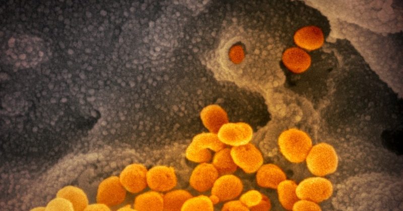 Doctor instructs to kill Covid-19 patient; FIR lodged