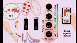 Smartphone-based testing could simplify Alzheimer's diagnosis