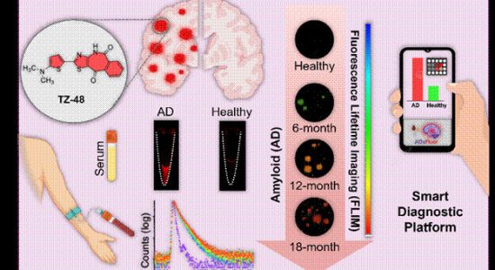 Smartphone-based testing could simplify Alzheimer's diagnosis