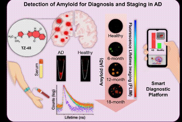 Smartphone-based testing could simplify Alzheimer's diagnosis