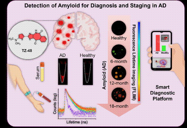 Smartphone-based testing could simplify Alzheimer's diagnosis